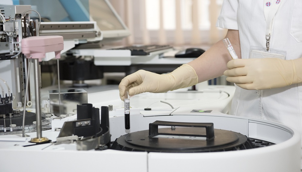 LaboratorijskeAnalizeEpruvete
